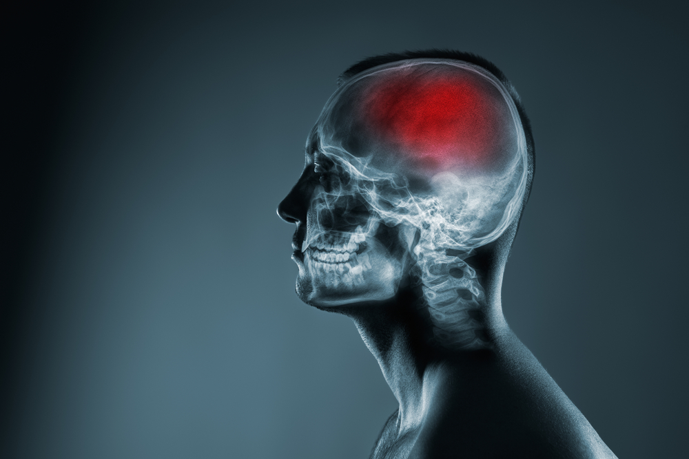 New Jersey Brain Injury Lawyers Traumatic Brain Injuries Affect Women and Girls Differently, Says Study